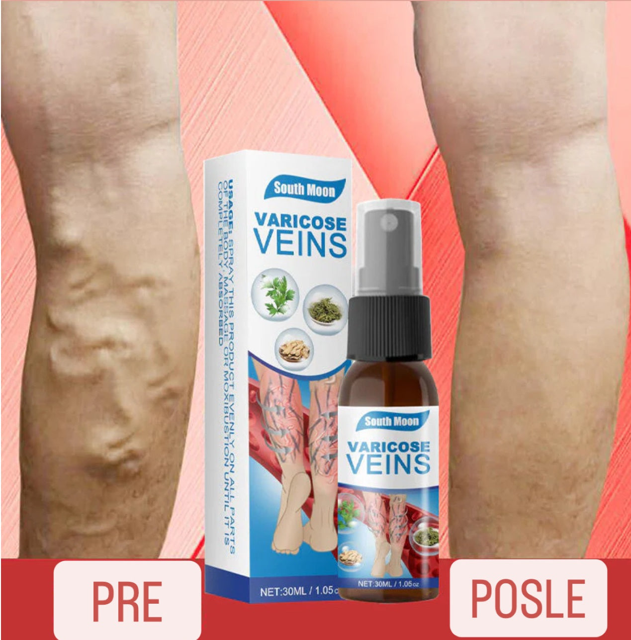 Veins Spray – Tajna Laganih i Zdravih Nogu! 1+1 Gratis