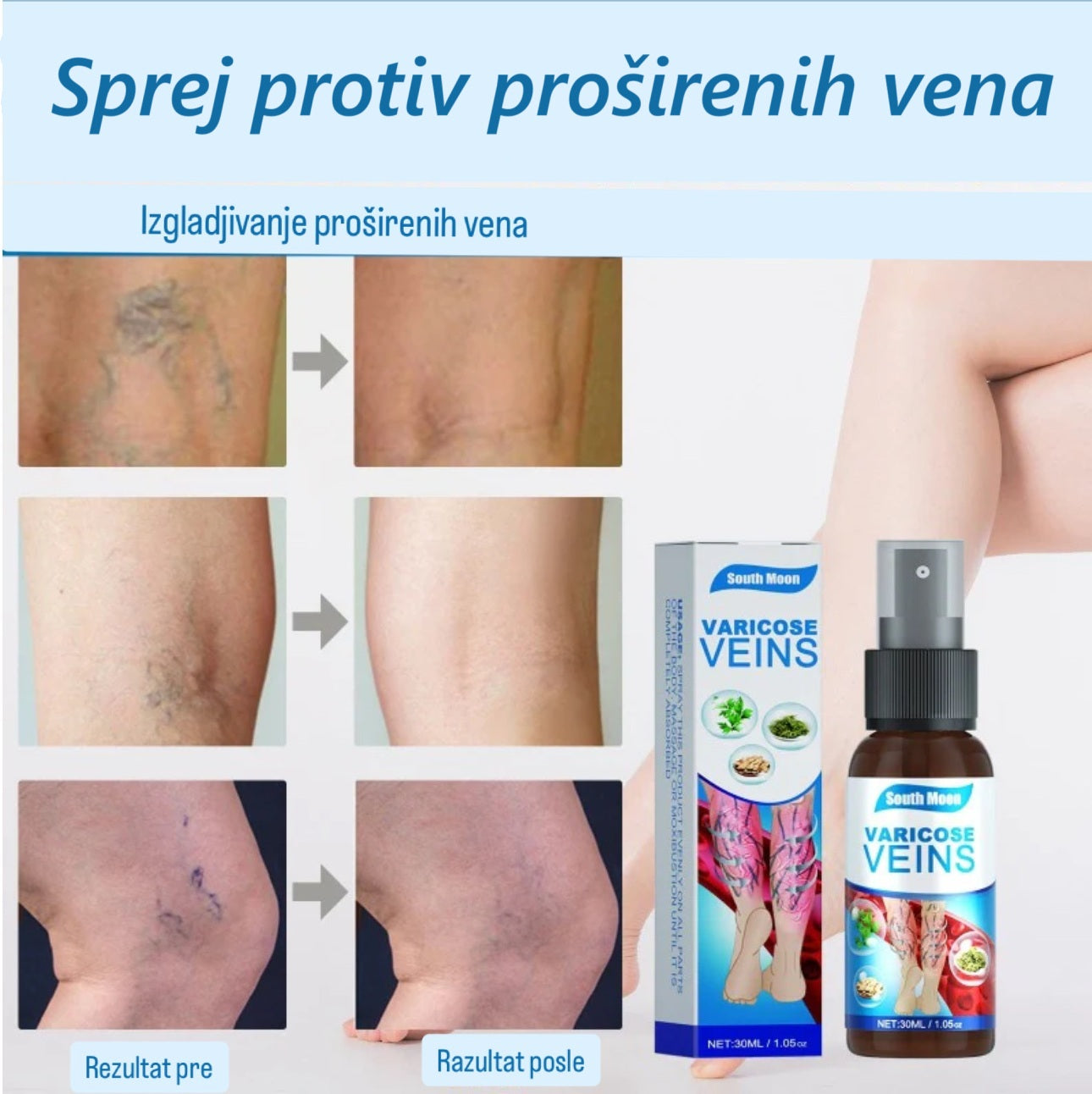 Veins Spray – Tajna Laganih i Zdravih Nogu! 1+1 Gratis